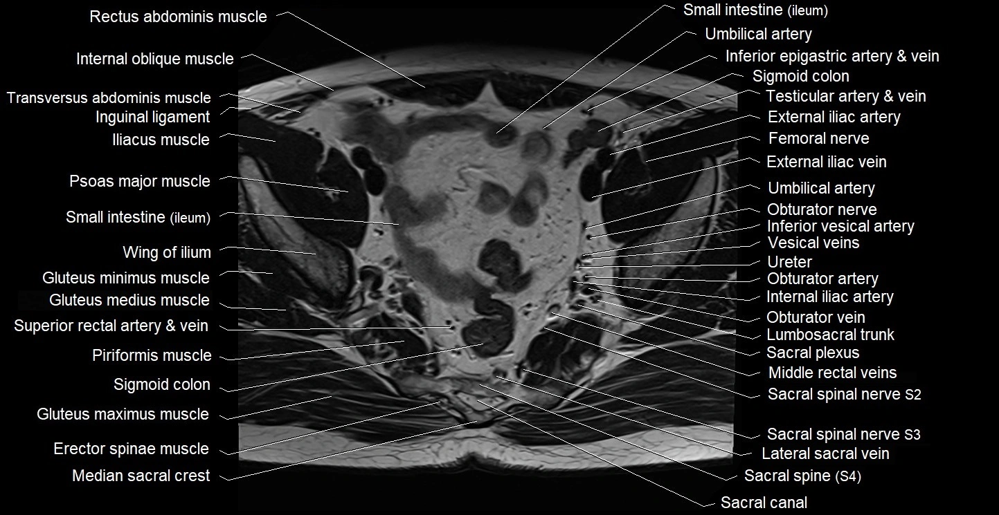 Male pelvis axial cross sectional anatomy image 14.webp